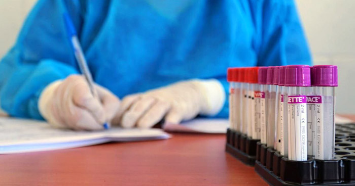 Presidente Bukele anuncia realización de pruebas a 4 pacientes con sospecha de coronavirus presidente-bukele-anuncia-realizacion-de-pruebas-a-4-pacientes-con-sospecha-de-coronavirus